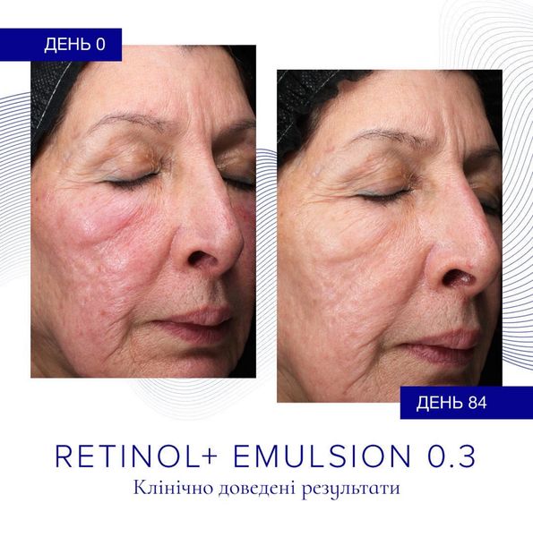 Відновлювальна емульсія з ретинолом iS Clinical Retinol + Emulsion 0.3 30 g 000099 фото