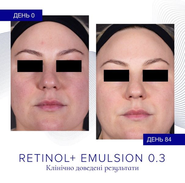 Восстановительная эмульсия с ретинолом iS Clinical Retinol + Emulsion 0.3 30 g 000099 фото