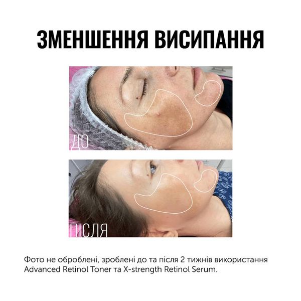 Тонер з ретинолом Instytutum Advanced Retinol Toner 50 ml 000052 фото