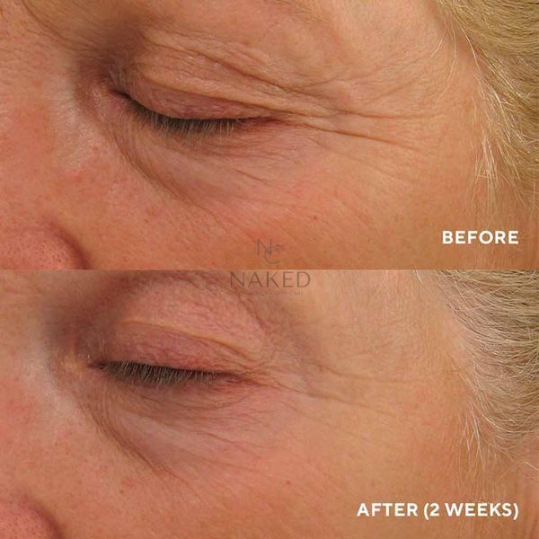 Інтенсивний ліфтинг-крем для повік HydroPeptide Eye Authority 15 ml 000690 фото