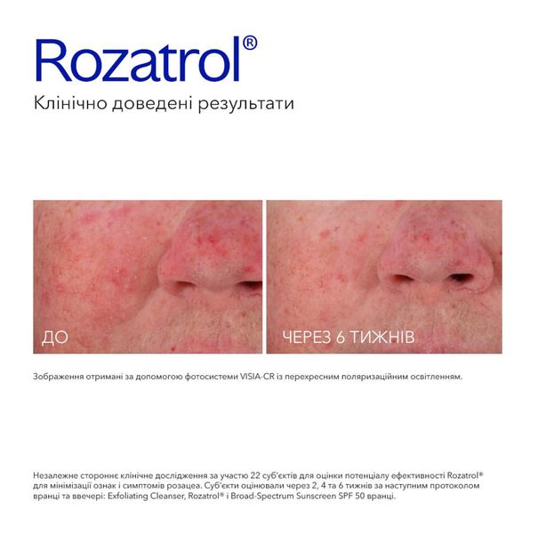 Сыворотка для ухода за чувствительной или воспаленной кожей ZO Skin Health Rozatrol 20 ml 000059 фото