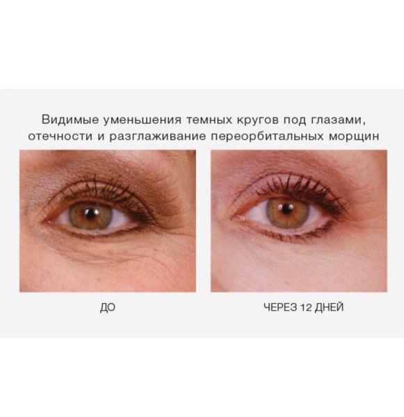 Крем для омоложения кожи вокруг глаз iS Clinical Youth Eye Complex 15 ml 000181 фото