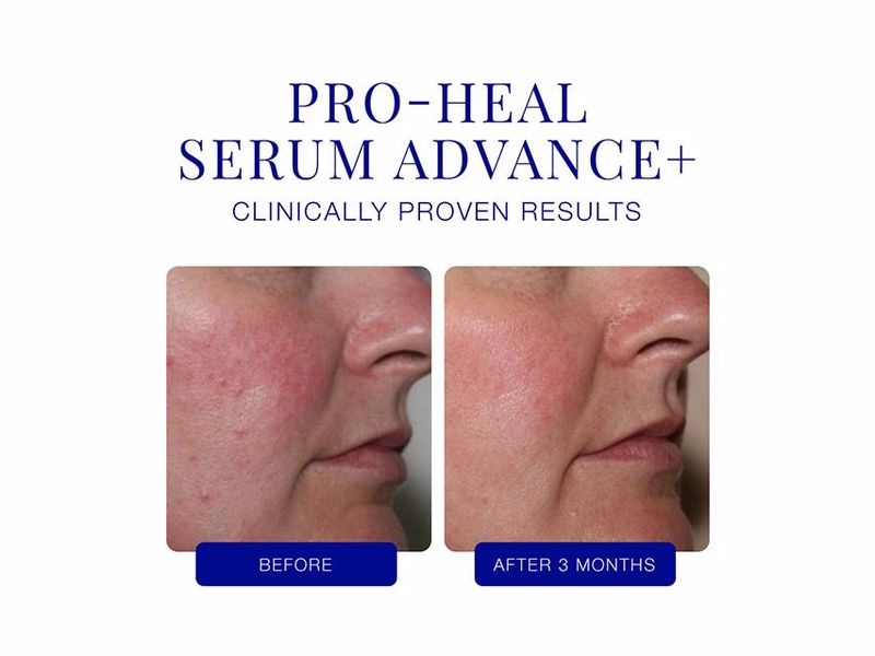 Загоююча та заспокійлива сироватка для обличчя iS Clinical Pro-Heal Serum Advance 15 ml 000084 фото