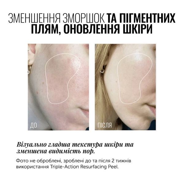 Пілінг для обличчя потрійної дії Instytutum Triple Action Resurfacing Peel 20 ml 000035 фото