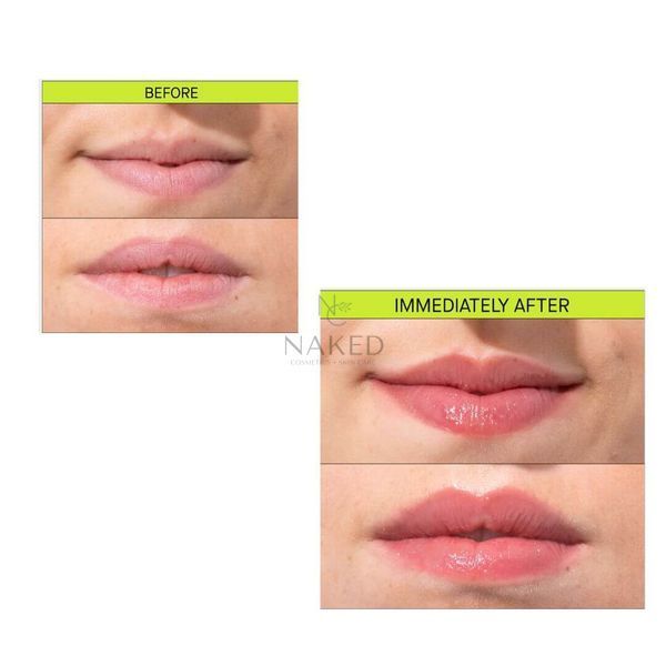Средство для увлажнения и объема губ Transparent Lab Volume Hydro Plump Lip Augmentation 15 ml 000578 фото